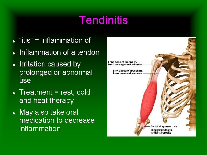 Tendinitis “itis” = inflammation of Inflammation of a tendon Irritation caused by prolonged or