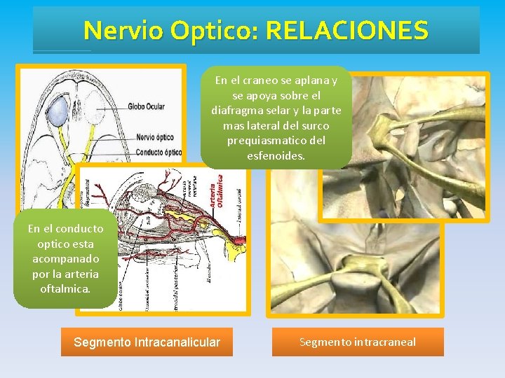 Nervio Optico: RELACIONES En el craneo se aplana y se apoya sobre el diafragma