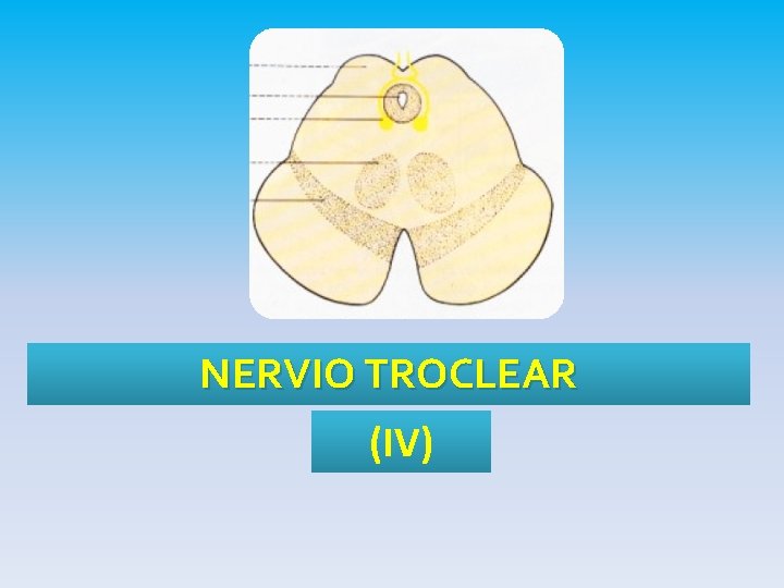 NERVIO TROCLEAR (IV) 