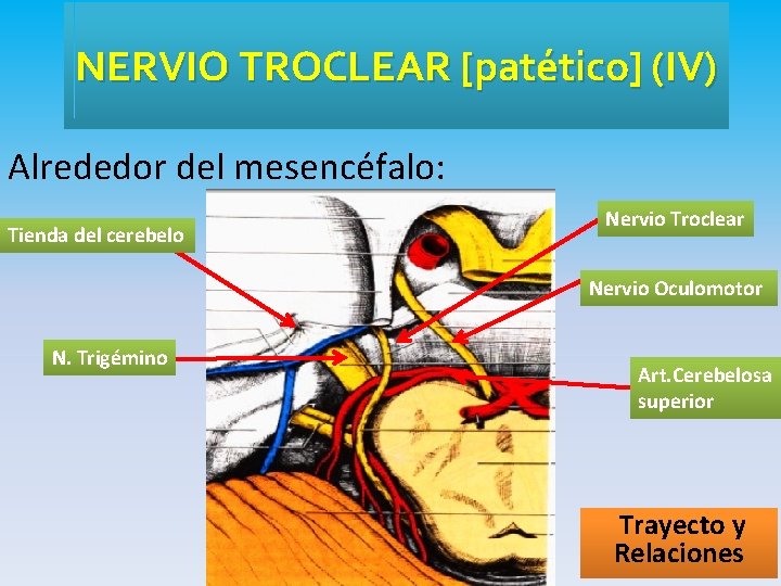 NERVIO TROCLEAR [patético] (IV) Alrededor del mesencéfalo: Tienda del cerebelo Nervio Troclear Nervio Oculomotor