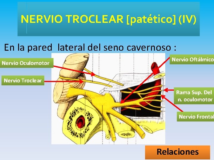 NERVIO TROCLEAR [patético] (IV) En la pared lateral del seno cavernoso : Nervio Oculomotor