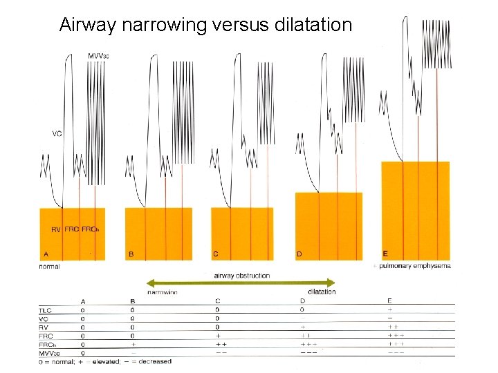 Airway narrowing versus dilatation 