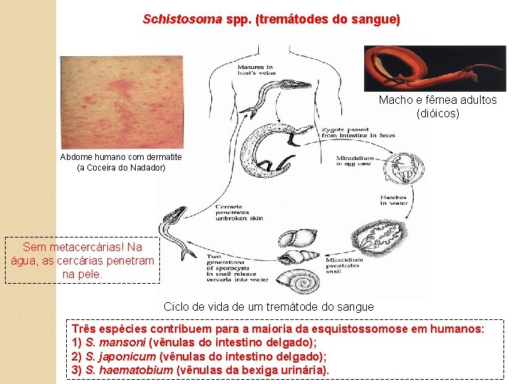 Schistosoma spp. (tremátodes do sangue) Macho e fêmea adultos (dióicos) Abdome humano com dermatite