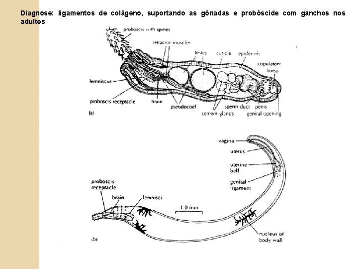 Diagnose: ligamentos de colágeno, suportando as gônadas e probóscide com ganchos nos adultos 