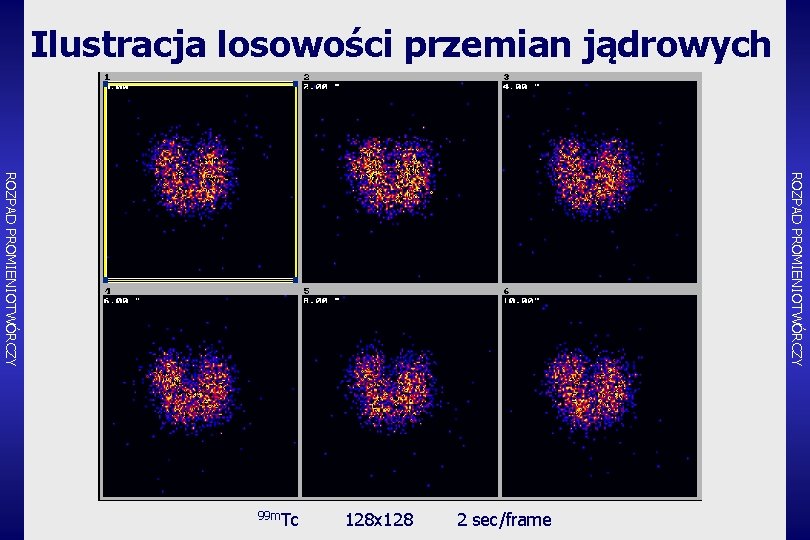 Ilustracja losowości przemian jądrowych ROZPAD PROMIENIOTWÓRCZY 99 m. Tc 128 x 128 2 sec/frame