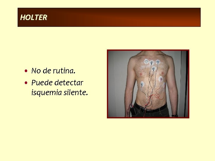HOLTER • No de rutina. • Puede detectar isquemia silente. 