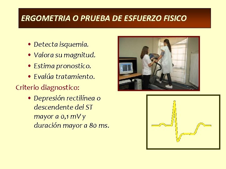 ERGOMETRIA O PRUEBA DE ESFUERZO FISICO • Detecta isquemia. • Valora su magnitud. •