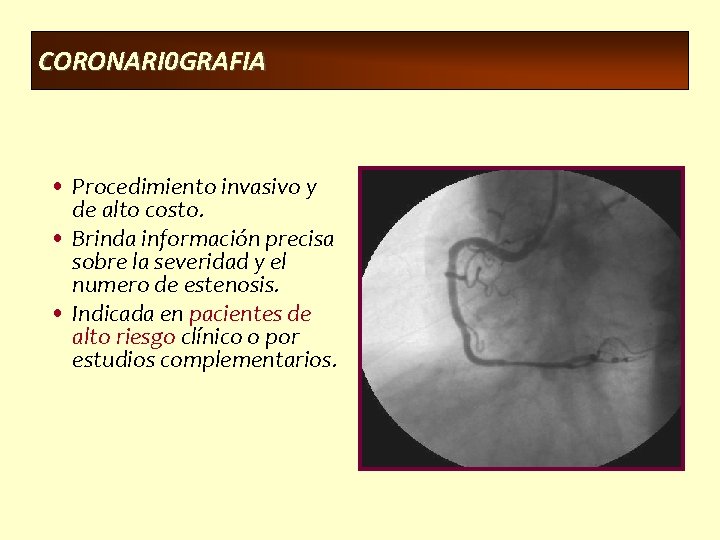 CORONARI 0 GRAFIA • Procedimiento invasivo y de alto costo. • Brinda información precisa