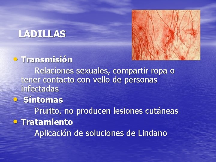 LADILLAS • Transmisión • • Relaciones sexuales, compartir ropa o tener contacto con vello