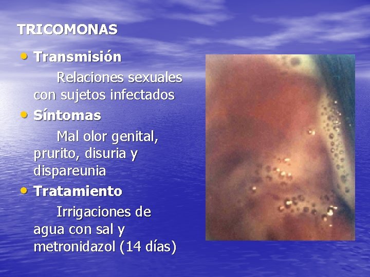 TRICOMONAS • Transmisión • • Relaciones sexuales con sujetos infectados Síntomas Mal olor genital,