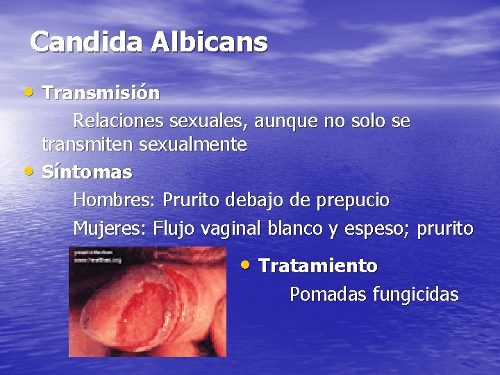 Candida Albicans • Transmisión • Relaciones sexuales, aunque no solo se transmiten sexualmente Síntomas