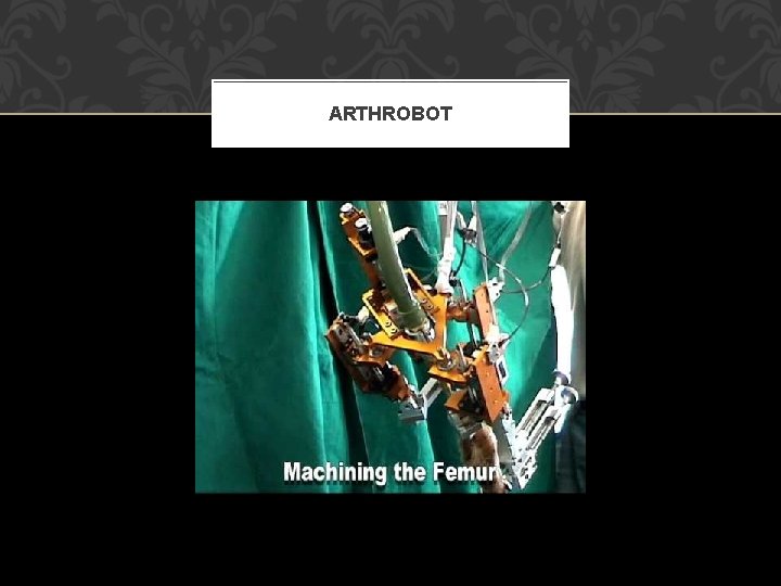 ARTHROBOT 