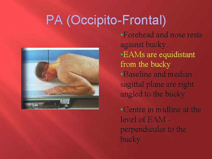 PA (Occipito-Frontal) • Forehead and nose rests against bucky. • EAMs are equidistant from