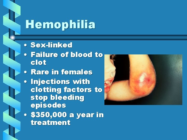 Hemophilia • Sex-linked • Failure of blood to clot • Rare in females •