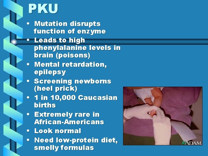 PKU • Mutation disrupts function of enzyme • Leads to high phenylalanine levels in