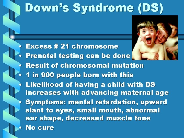 Down’s Syndrome (DS) • • • Excess # 21 chromosome Prenatal testing can be