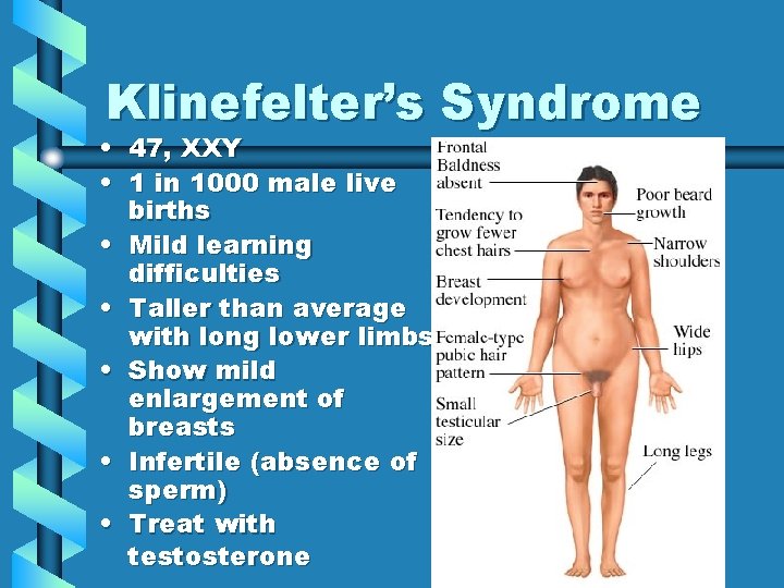 Klinefelter’s Syndrome • • 47, XXY 1 in 1000 male live births Mild learning