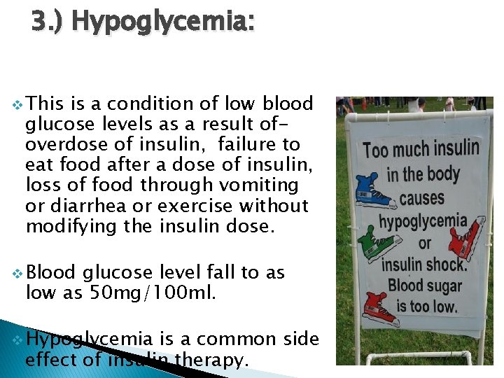 3. ) Hypoglycemia: v This is a condition of low blood glucose levels as