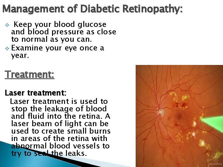 Management of Diabetic Retinopathy: Keep your blood glucose and blood pressure as close to