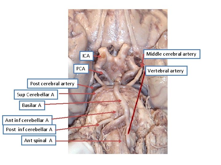 ICA Post cerebral artery Sup Cerebellar A Basilar A Ant inf cerebellar A Post