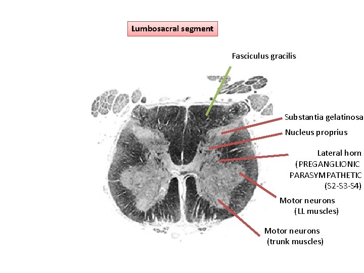 Lumbosacral segment Fasciculus gracilis Substantia gelatinosa Nucleus proprius Lateral horn (PREGANGLIONIC PARASYMPATHETIC (S 2