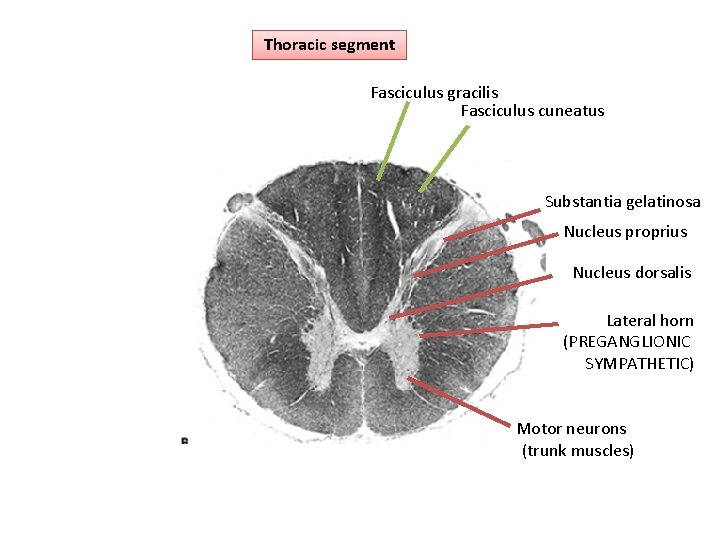 Thoracic segment Fasciculus gracilis Fasciculus cuneatus Substantia gelatinosa Nucleus proprius Nucleus dorsalis Lateral horn
