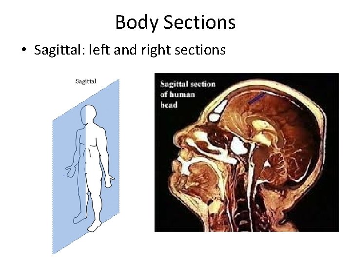 Body Sections • Sagittal: left and right sections Body Sections • Sagittal: left and right sections