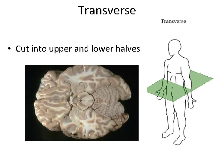 Transverse • Cut into upper and lower halves Transverse • Cut into upper and lower halves