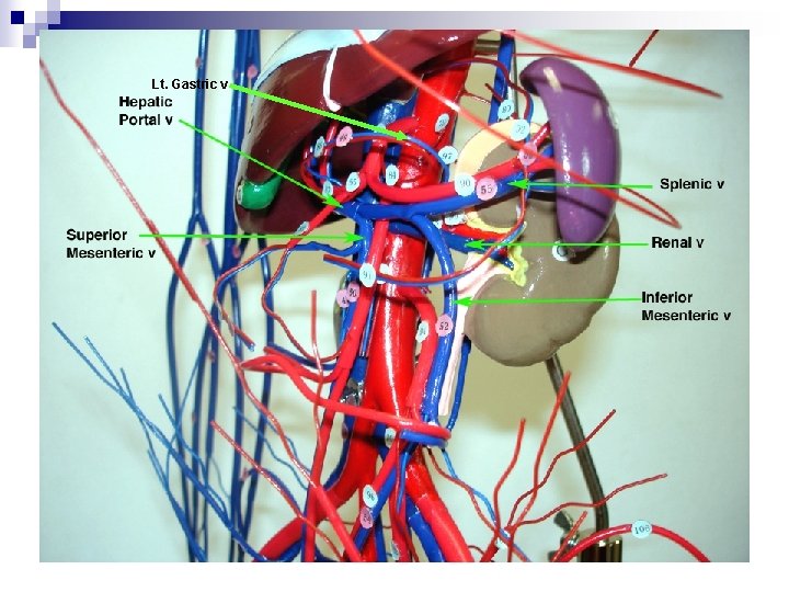 Lt. Gastric v 