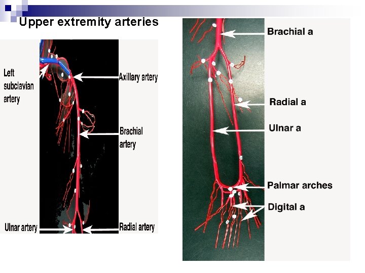 Upper extremity arteries 
