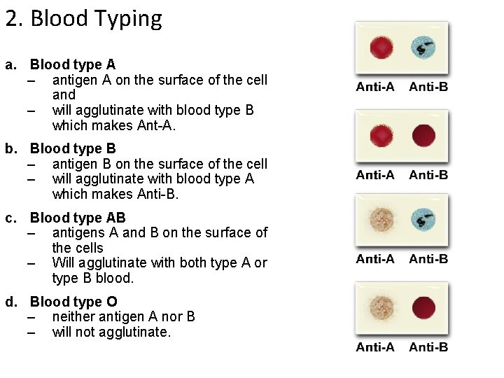 2. Blood Typing a. Blood type A – antigen A on the surface of