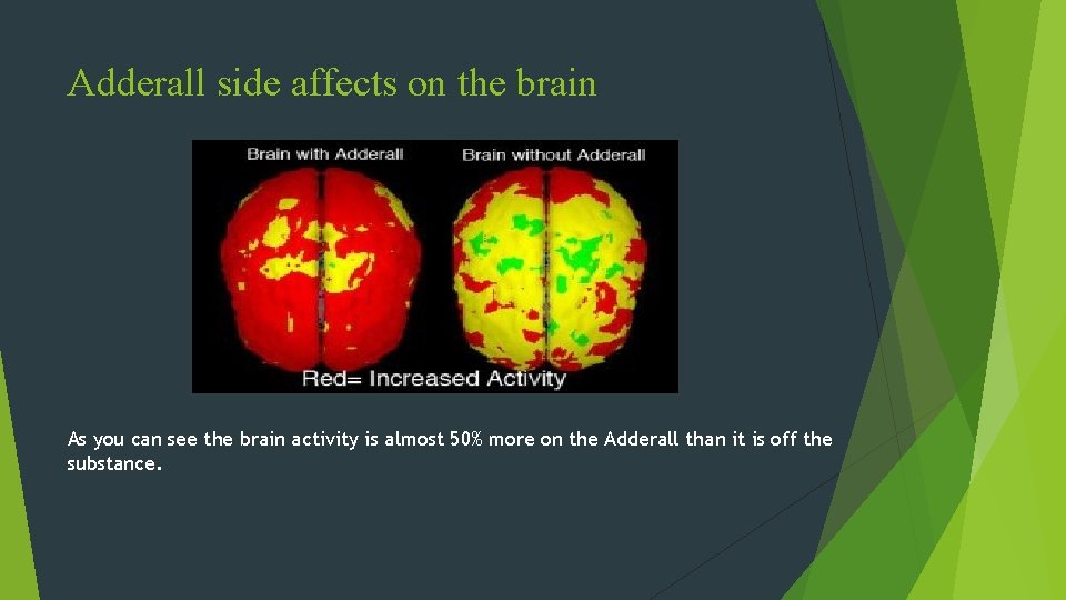 Adderall side affects on the brain As you can see the brain activity is