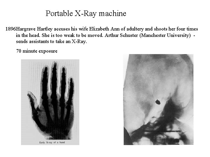 Portable X-Ray machine 1896 Hargrave Hartley accuses his wife Elizabeth Ann of adultery and