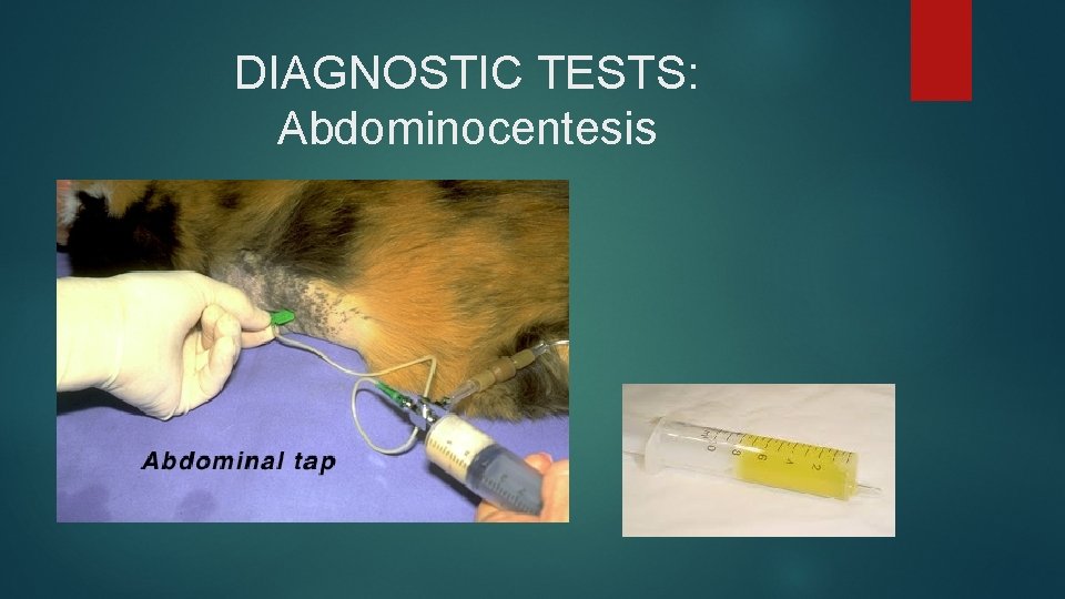 DIAGNOSTIC TESTS: Abdominocentesis 