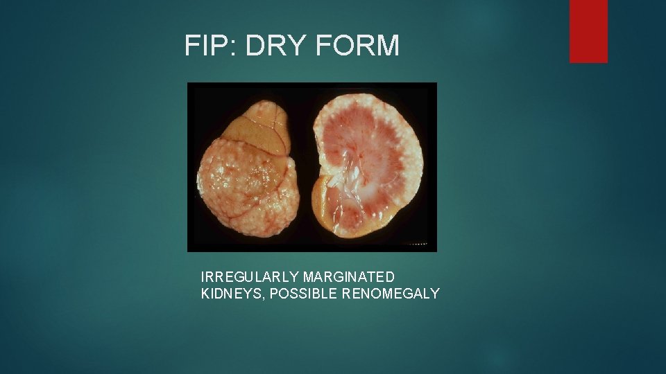 FIP: DRY FORM IRREGULARLY MARGINATED KIDNEYS, POSSIBLE RENOMEGALY 