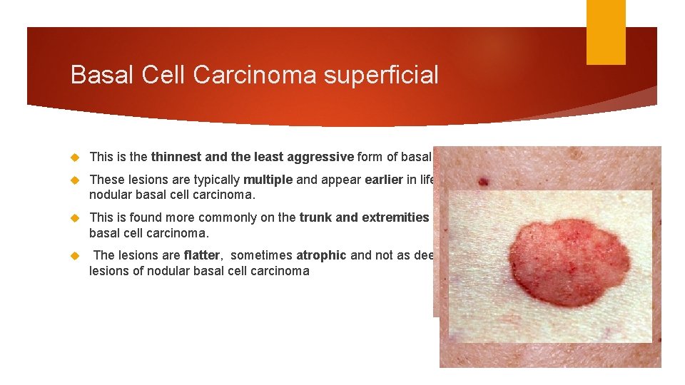 Basal Cell Carcinoma superficial This is the thinnest and the least aggressive form of