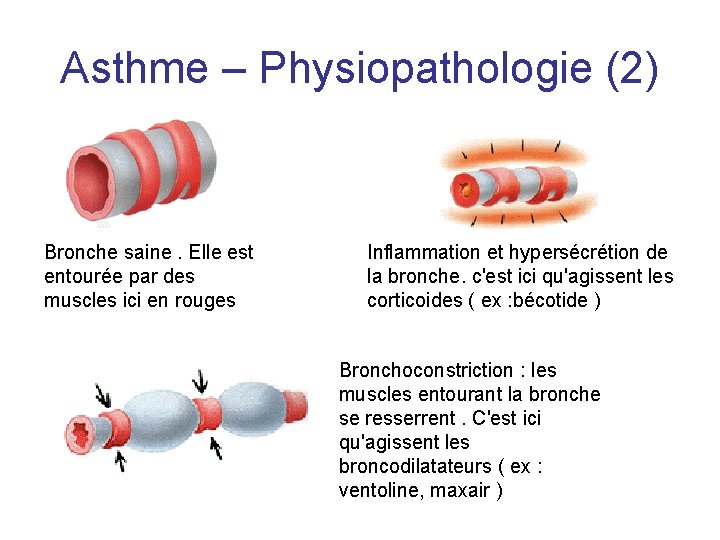 Asthme – Physiopathologie (2) Bronche saine. Elle est entourée par des muscles ici en