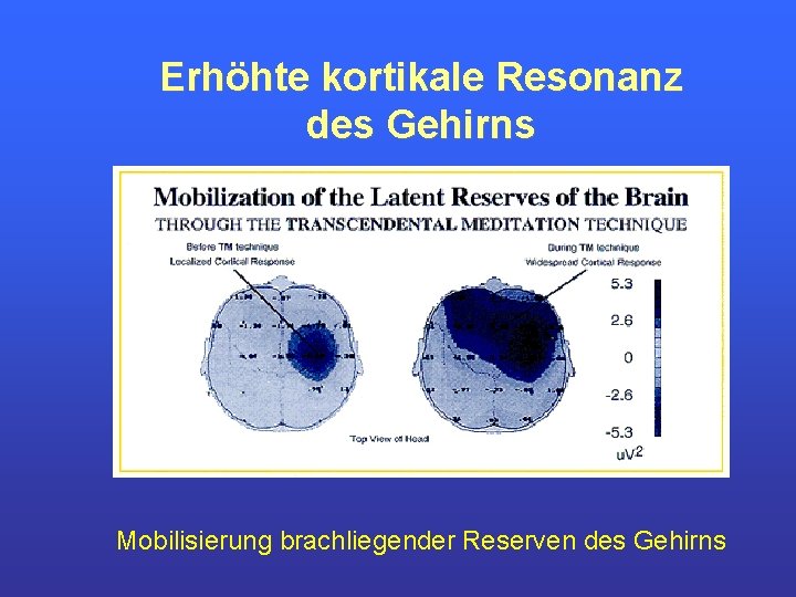 Erhöhte kortikale Resonanz des Gehirns Mobilisierung brachliegender Reserven des Gehirns 