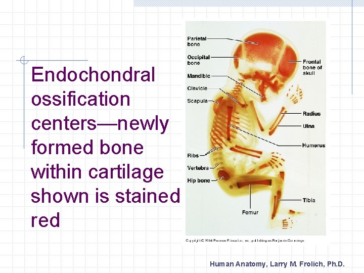 Endochondral ossification centers—newly formed bone within cartilage shown is stained red Human Anatomy, Larry