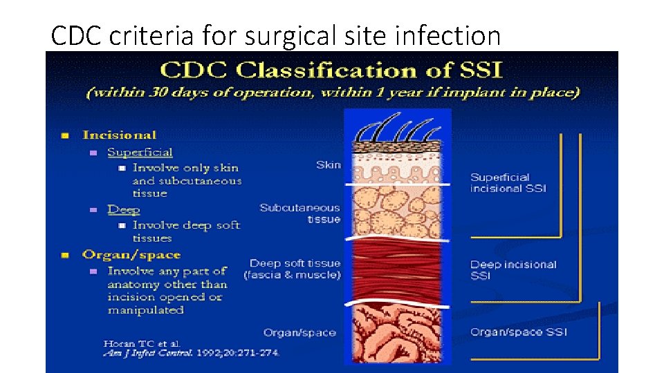 CDC criteria for surgical site infection 