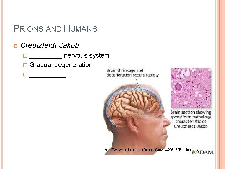 PRIONS AND HUMANS Creutzfeldt-Jakob � _____ nervous system � Gradual degeneration � _____ http:
