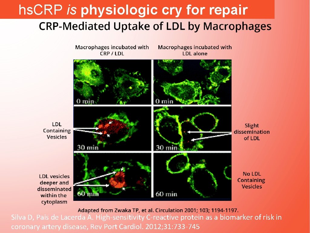 hs. CRP is physiologic cry for repair Silva D, Pais de Lacerda A. High-sensitivity