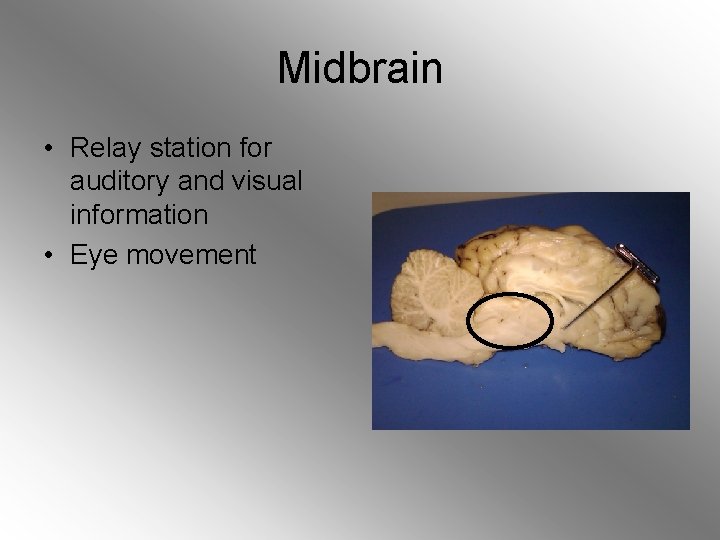 Midbrain • Relay station for auditory and visual information • Eye movement 