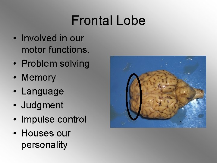 Frontal Lobe • Involved in our motor functions. • Problem solving • Memory •