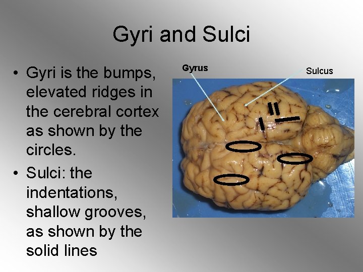 Gyri and Sulci • Gyri is the bumps, elevated ridges in the cerebral cortex