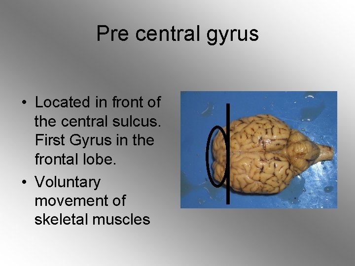 Pre central gyrus • Located in front of the central sulcus. First Gyrus in