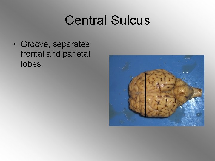 Central Sulcus • Groove, separates frontal and parietal lobes. 