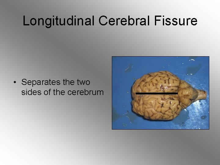 Longitudinal Cerebral Fissure • Separates the two sides of the cerebrum 