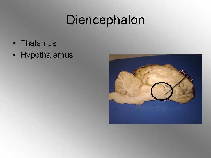 Diencephalon • Thalamus • Hypothalamus 