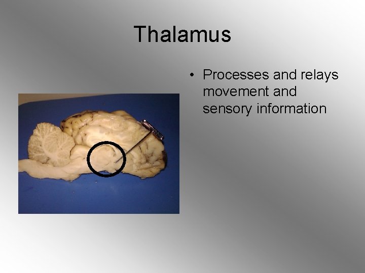 Thalamus • Processes and relays movement and sensory information 